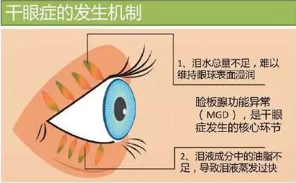 看图说话,眼干是病!得治!