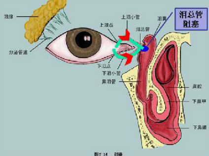 娱乐 社区 图说上海 挑战编辑部 如果把泪道(眼睛的排水系统)比喻为"