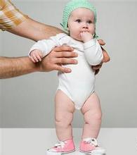 宝宝八字脚怎么办?