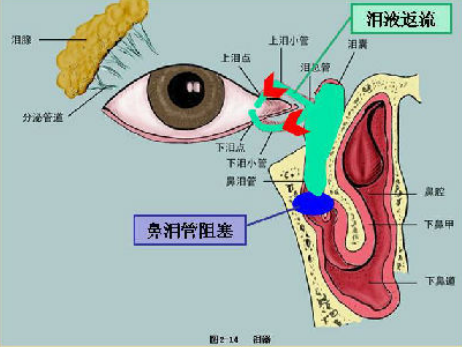娱乐 社区 图说上海 挑战编辑部 如果把泪道(眼睛的排水系统)比喻为"