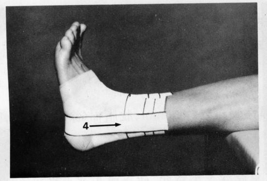 组图:踝关节的胶布固定方法(下)_滚动图集