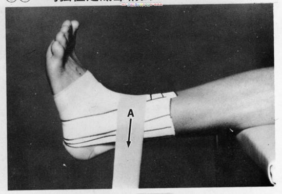 组图:踝关节的胶布固定方法(下)_滚动图集