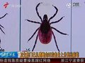 视频：卫生部门从遭蜱虫叮咬者身上分离出病毒