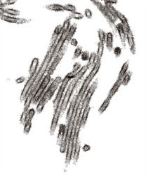 日本科学家拍到甲型H1N1流感病毒“真面目”