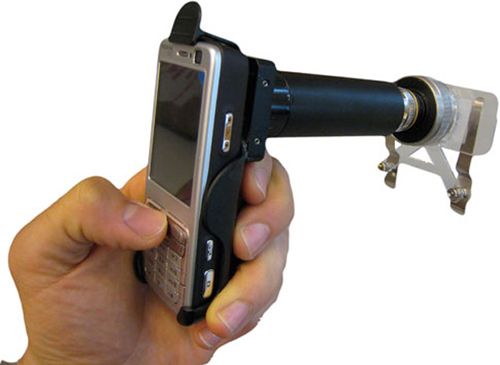 “手机显微镜”研制成功 可用以辨识疾病特征