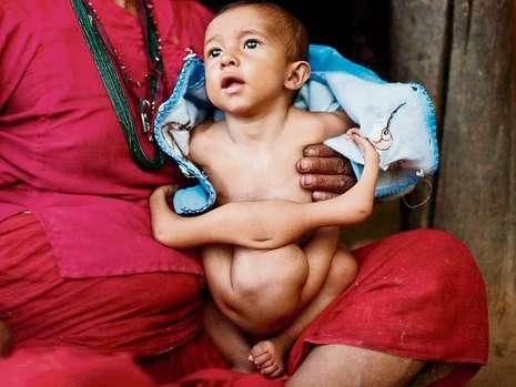 尼泊尔婴孩4条胳膊4条腿 被当地人奉为神灵