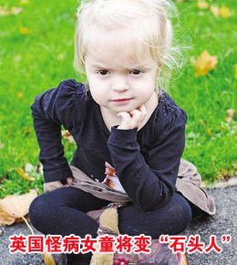 ӢŮͯ���䡰ʯͷ�ˡ� ���޷������Ľᾧ�ֲ�