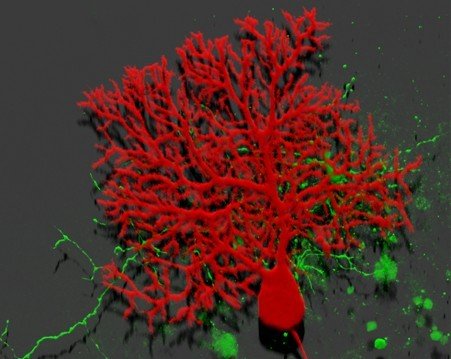 小鼠小脑部位的的运动神经元细胞