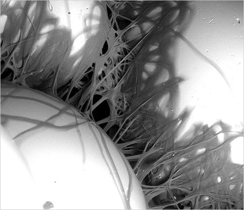 科学家在一种蠕虫身上发现“超级胶水”(图)