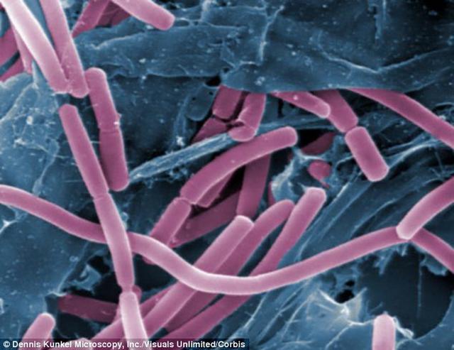 [天文航天]地球超级微生物可能偷渡火星成为新