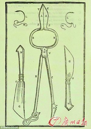 古籍显示意大利400多年前已有鼻子整形术(图)
