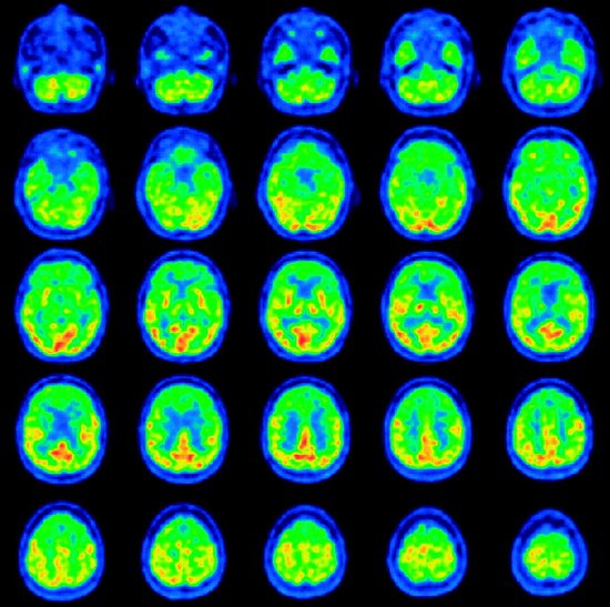 美国科学家称脑部扫描能鉴别出勤快人和懒人