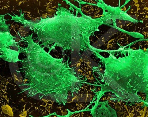 美科学家发现细胞机械性能变化可能导致癌症