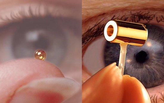 美国在激光受控核聚变领域取得突破