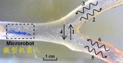 科学家开发微型机器人进入人体血管清除淤积
