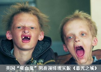 “吸血鬼”男孩演绎现实版《暮光之城》