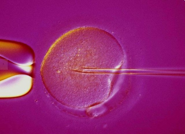 单精子注射受精违反自然规律或引发男性不育