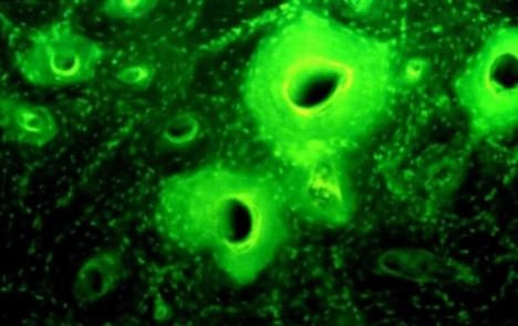 1500年前努比亚人懂得酿含四环素的药用啤酒