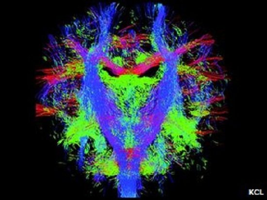 英科学家将绘制婴儿出生前后的神经发育图