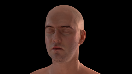 意大利科学家：人类头部移植手术或成为现实