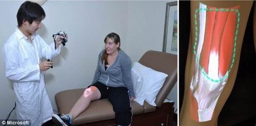 新型手持X射线装置可透视人体皮肤下骨骼结构