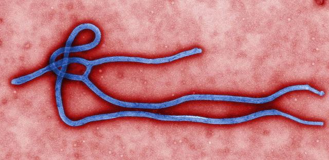 埃博拉病毒爆发或将成为人类历史最致命灾难