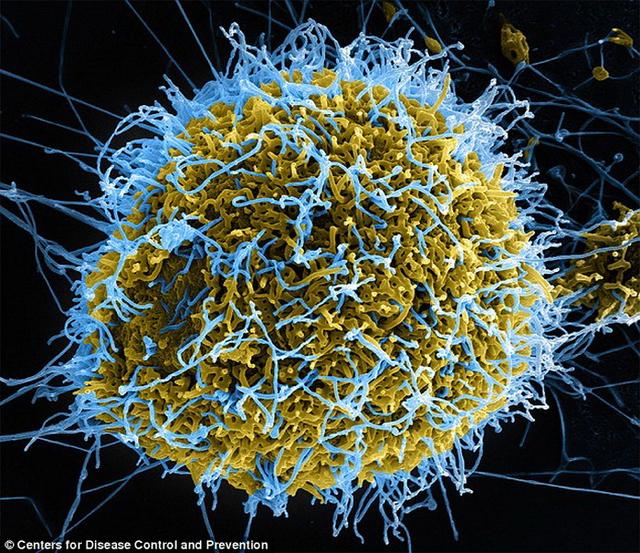 科学家发现埃博拉病毒2300万年前“祖先”