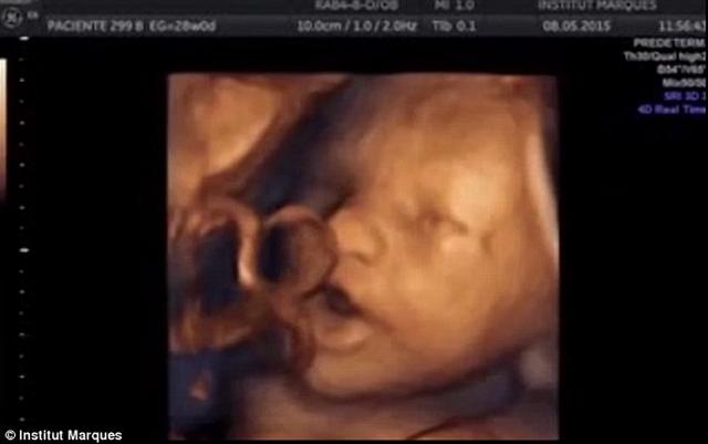 胎儿四个月大即可听懂音乐 会张嘴动舌头