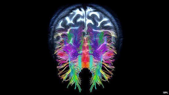 科学家试图培养具备基本自我意识的“大脑”