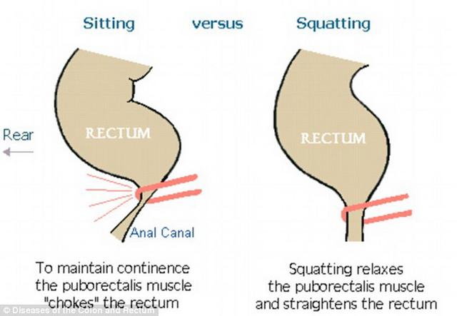 专家指出：坐着大便不好 容易罹患疾病