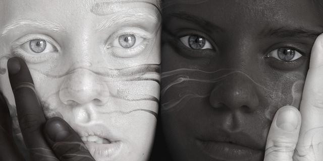 科学家称非洲祖先进化出黑皮肤是预防癌症