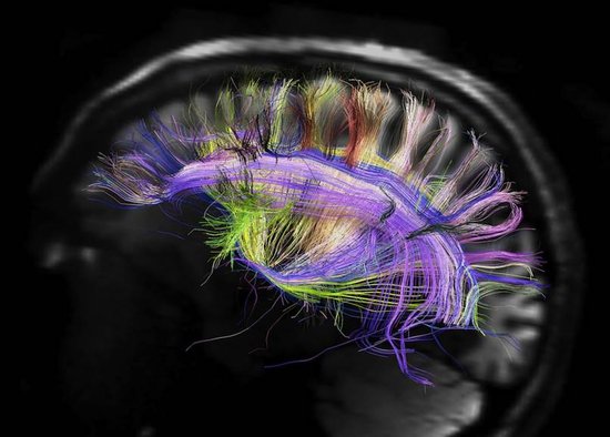 奇特大脑细节效果图 神经纤维排列如网络