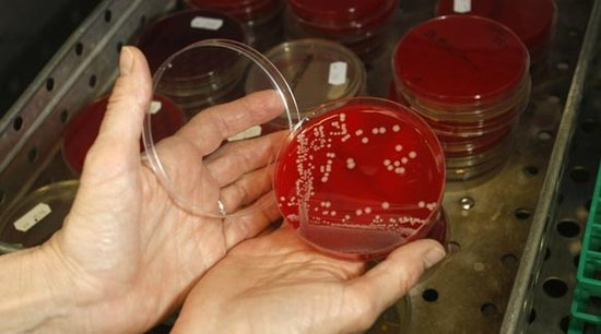 研究人员在野生动物中发现耐药性超级细菌