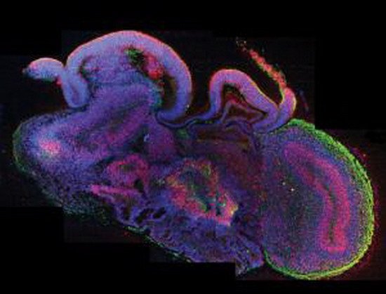 科学家用多功能干细胞首次培育微型人类大脑