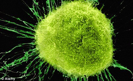 瑞士发现癌细胞扩散蛋白质 或开启治疗新途径