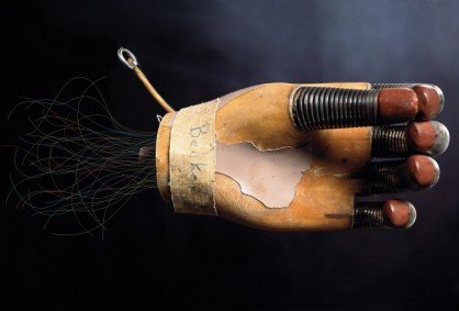 揭秘高科技仿生手臂：肌肉与神经间完美融合