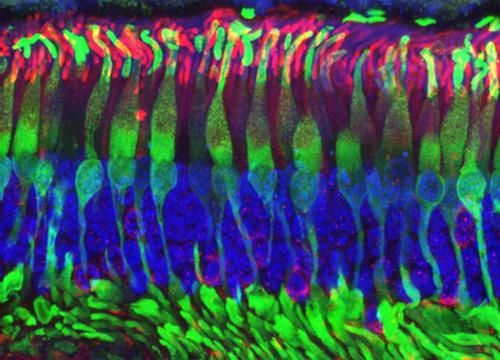 科学家用干细胞培育出微型视网膜