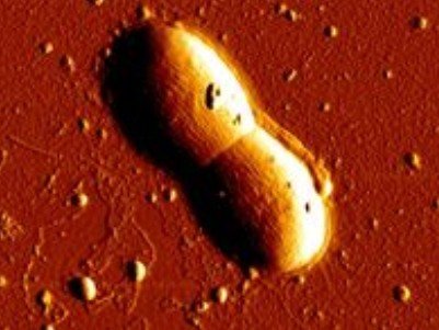 深海打捞出神秘生物：古老细菌挑战生命极限