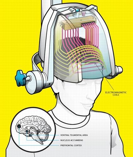 科学与道德的博弈:活体人脑取样实验(图)