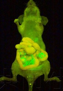 日美科学家研发新型喷雾剂 可辨别癌细胞(图)