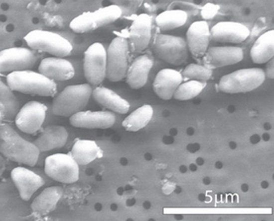 强悍细菌只是过滤砷元素 并非“砷基生命”