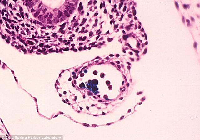 基因突变是延年益寿的“秘方”