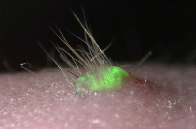 日本科学家人工培育皮肤组织 能长毛发分泌汗