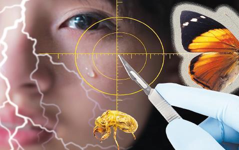 18岁少女削骨后下巴脱落!整容变毁容因为嘛?