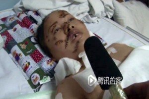 深圳女子收债被砍60余刀 装死跳车逃生 