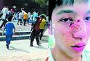 800 estudiantes en dos escuelas de campo de la caída de cuerpo a cuerpo