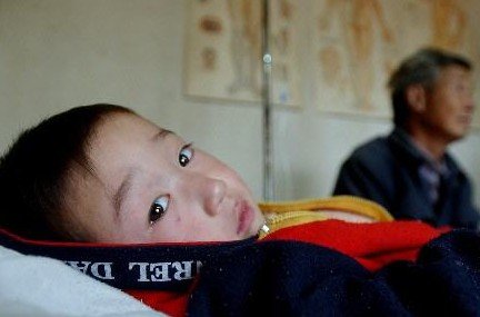 凤翔154名铅中毒儿童已住院治疗 部分患儿症状