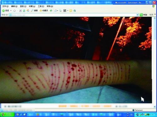 18岁少女失恋玩自残 自残照 刀刀见血(图)