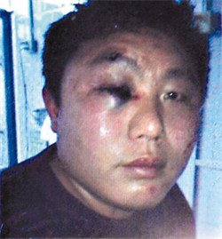 男子称酒店内发生口角被保安用猎枪顶头殴打