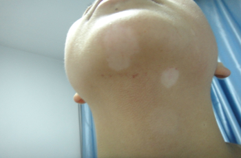 色素是什么样子 130563420.png